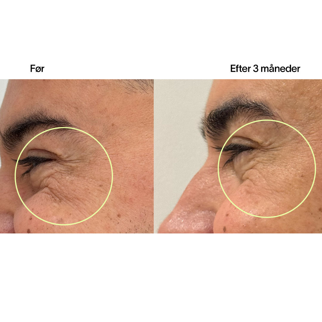 Collagen Tripeptides