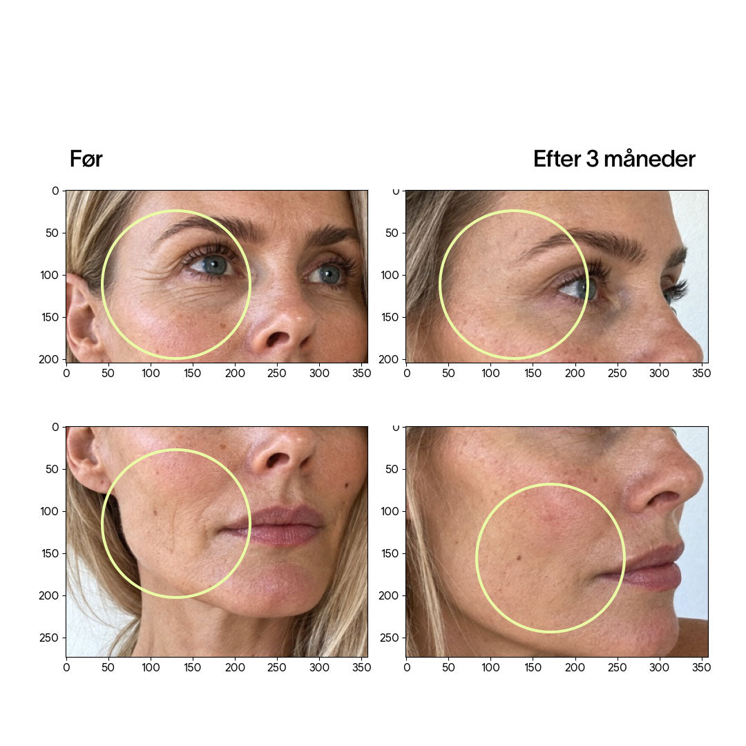Collagen Tripeptides