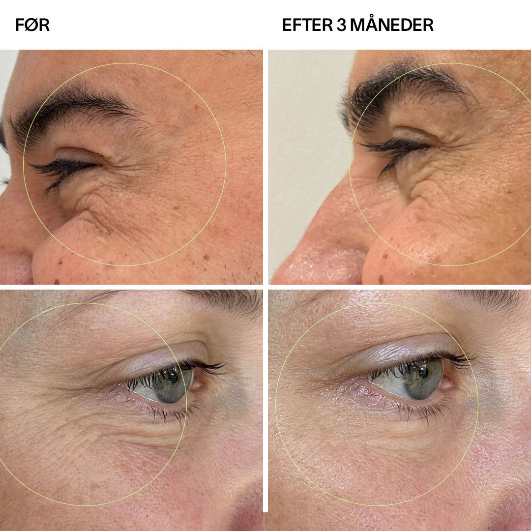 Collagen Tripeptides